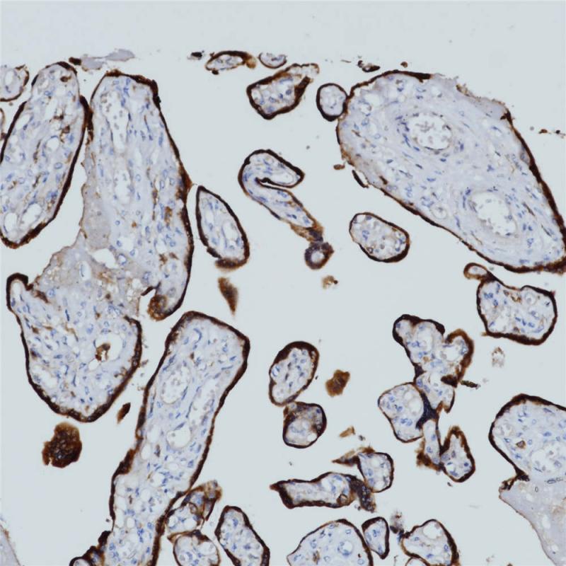 hCG Rabbit Monoclonal Antibody(ARB966)