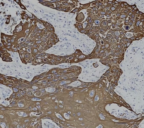Cytokeratin 17 Rabbit Monoclonal Antibody(ARB936)