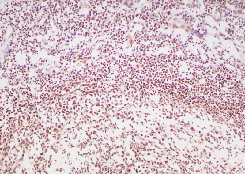 MGMT Rabbit Monoclonal Antibody(ARB988)