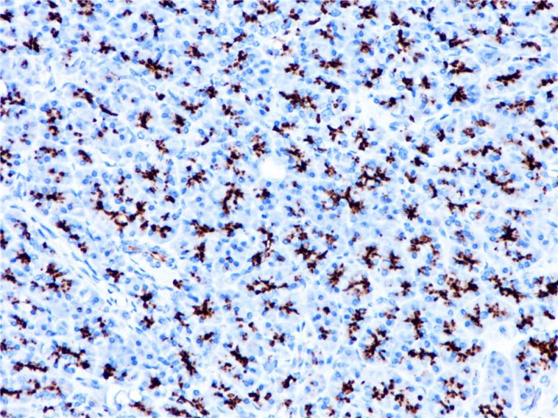 MUC1 Rabbit Monoclonal Antibody(ARB993)