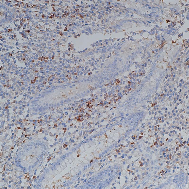 IgG Rabbit Monoclonal Antibody(ARB974)