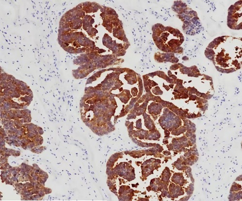 Claudin 6 Rabbit Monoclonal Antibody(ARB921)