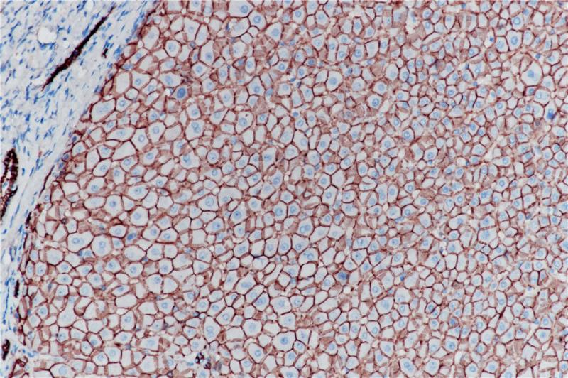E-Cadherin Rabbit Monoclonal Antibody(ARB945)