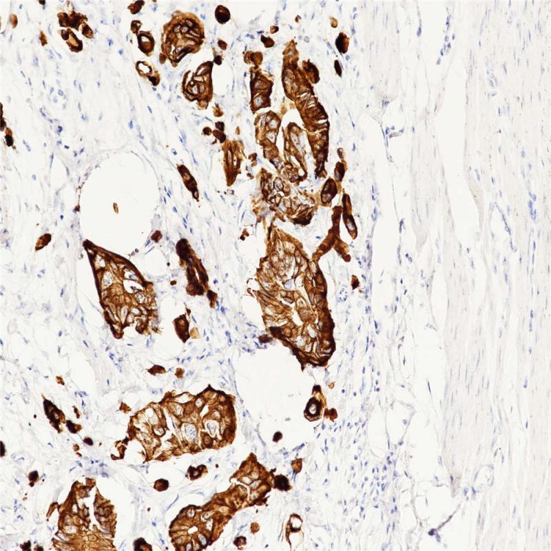 Cytokeratin 20 Rabbit Monoclonal Antibody(ARB938)