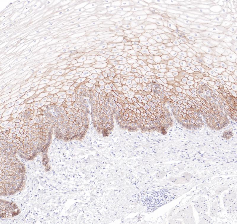 pan-Cadherin Rabbit Monoclonal Antibody(ARB517)