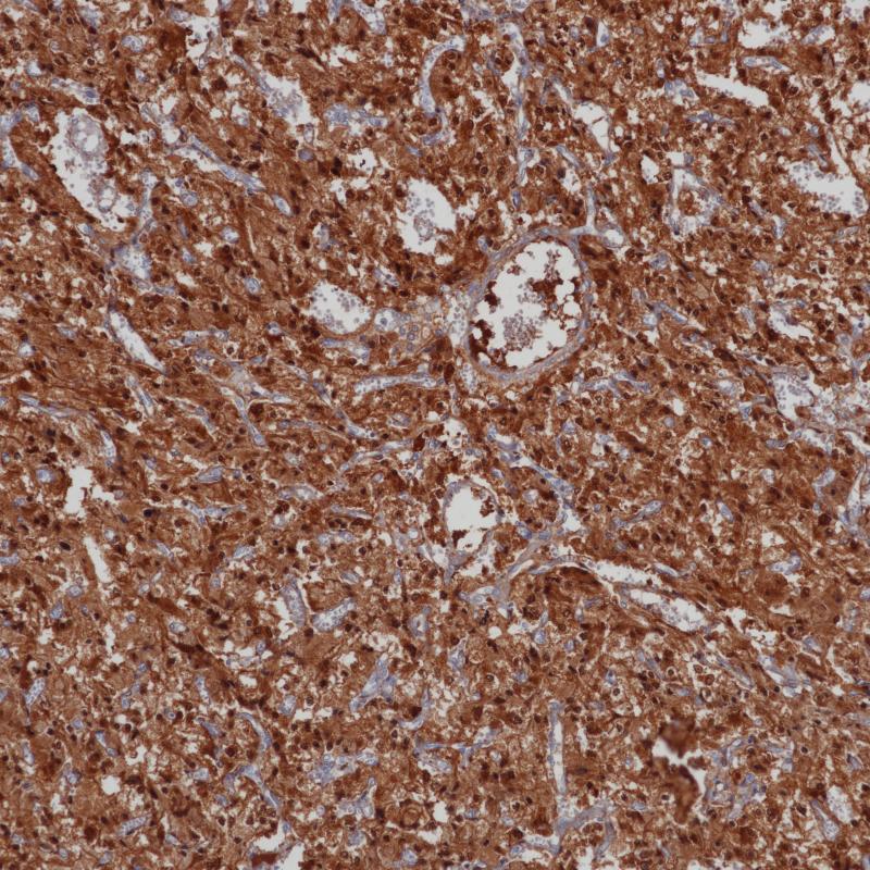 NSE Mouse Monoclonal Antibody(ARB509)