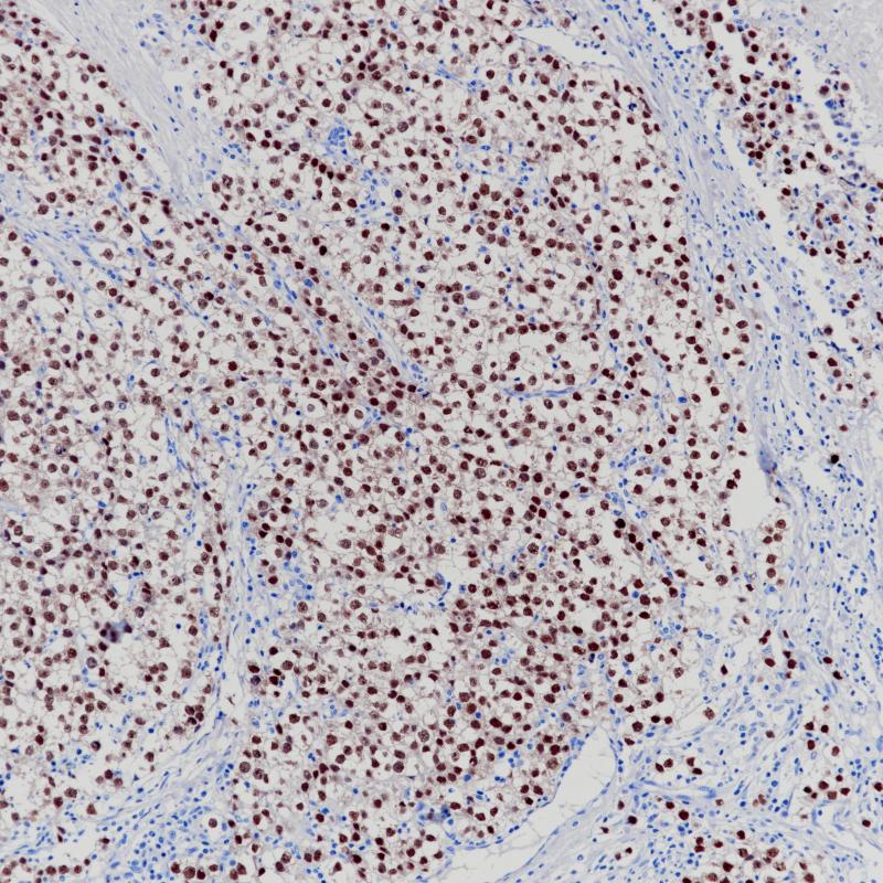 OCT3/4 Rabbit Monoclonal Antibody(ARB510)