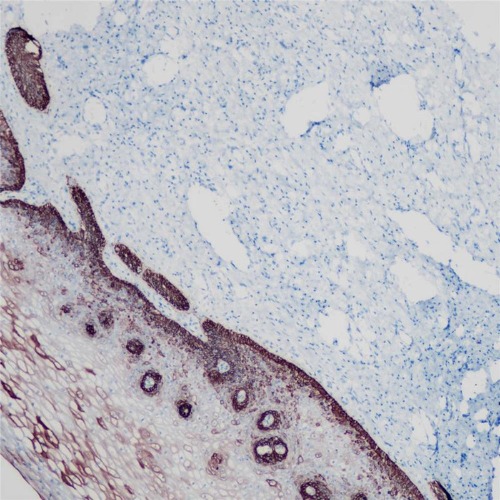 Cytokeratin 14 Rabbit Monoclonal Antibody(ARB935)