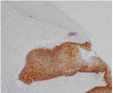 p16 Mouse Monoclonal Antibody(ARB515)