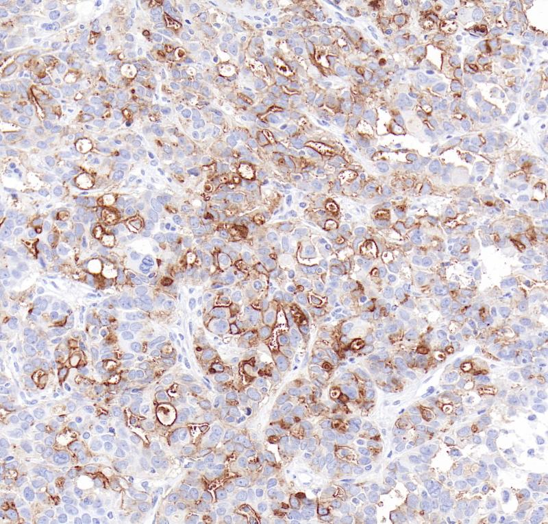 FR&alpha; Rabbit Monoclonal Antibody(ARB955)