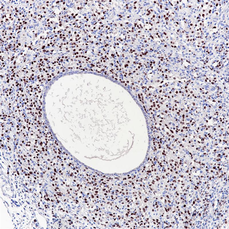 Myogenin Rabbit Monoclonal Antibody(ARB501)