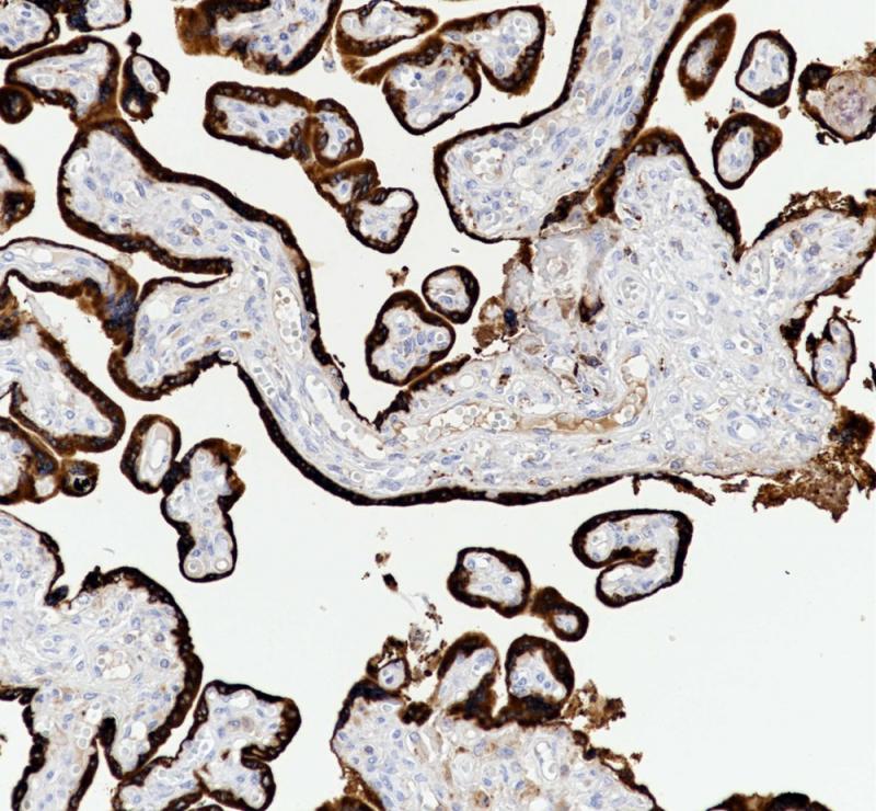 Human Placental Lactogen Rabbit Monoclonal Antibody(ARB970)