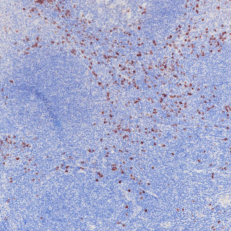 IgA Rabbit Monoclonal Antibody(ARB972)