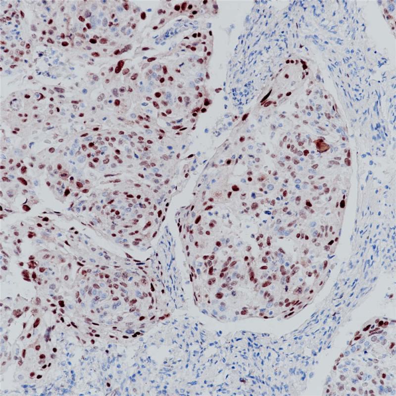 p21 Rabbit Monoclonal Antibody(ARB516)