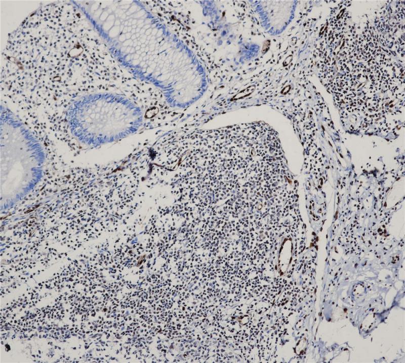 ERG Rabbit Monoclonal Antibody(ARB949)