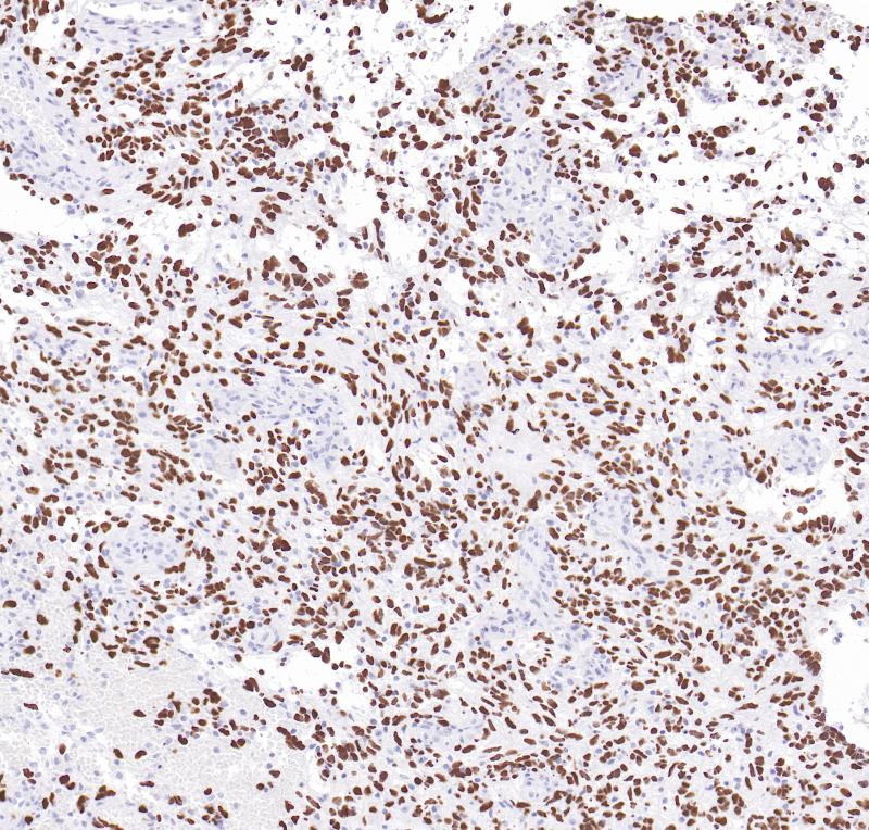 H3K27M Rabbit Monoclonal Antibody(ARB964)