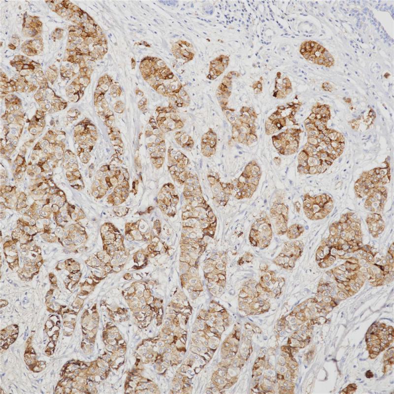GCDFP-15 Rabbit Monoclonal Antibody(ARB958)