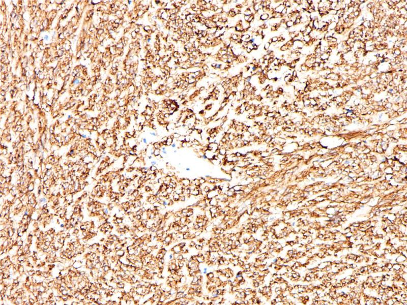 DOG1 Rabbit Monoclonal Antibody(ARB943)