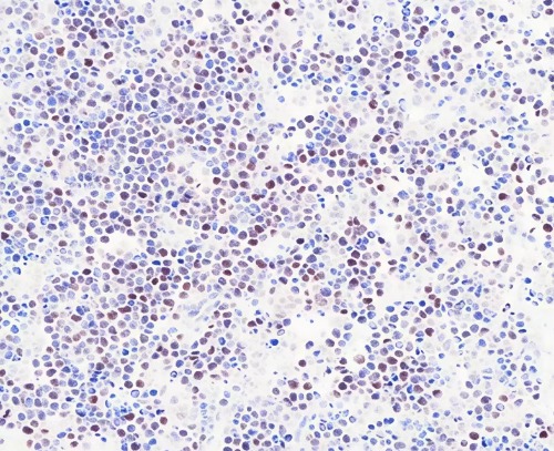 c-Myc Rabbit Monoclonal Antibody(ARB925)