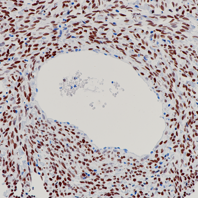 FOXL2 Rabbit Monoclonal Antibody(ARB953)