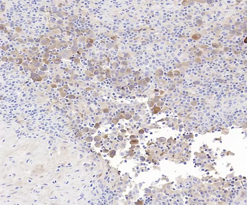 Clusterin Rabbit Monoclonal Antibody(ARB924)