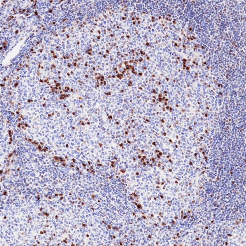 MUM1 Rabbit Monoclonal Antibody(ARB996)