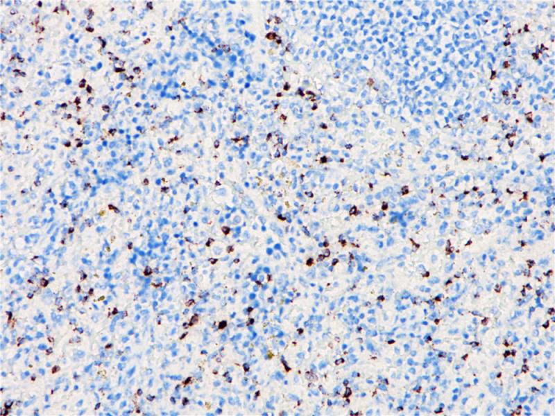 Granzyme B Rabbit Monoclonal Antibody(ARB962)