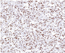 MYD88 L265P Rabbit Monoclonal Antibody(ARB998)