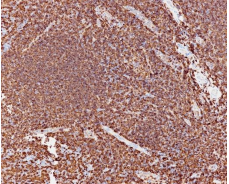 MHC Ⅱ Rabbit Monoclonal Antibody(ARB989)