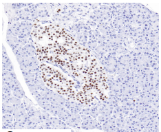 Islet-1 Rabbit Monoclonal Antibody(ARB978)