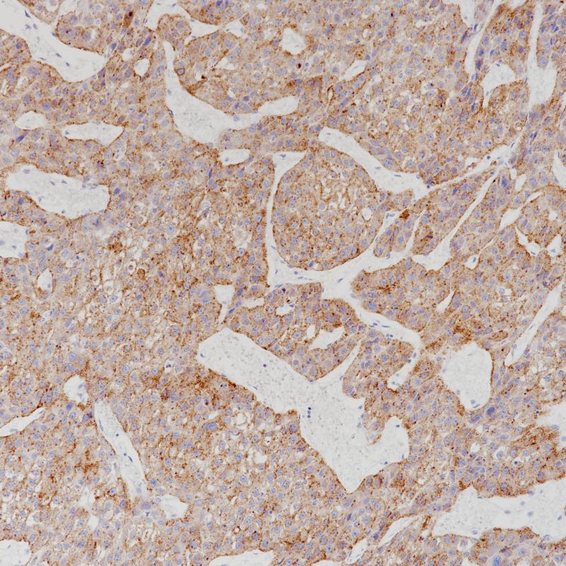 Glypican-3 Rabbit Monoclonal Antibody(ARB961)