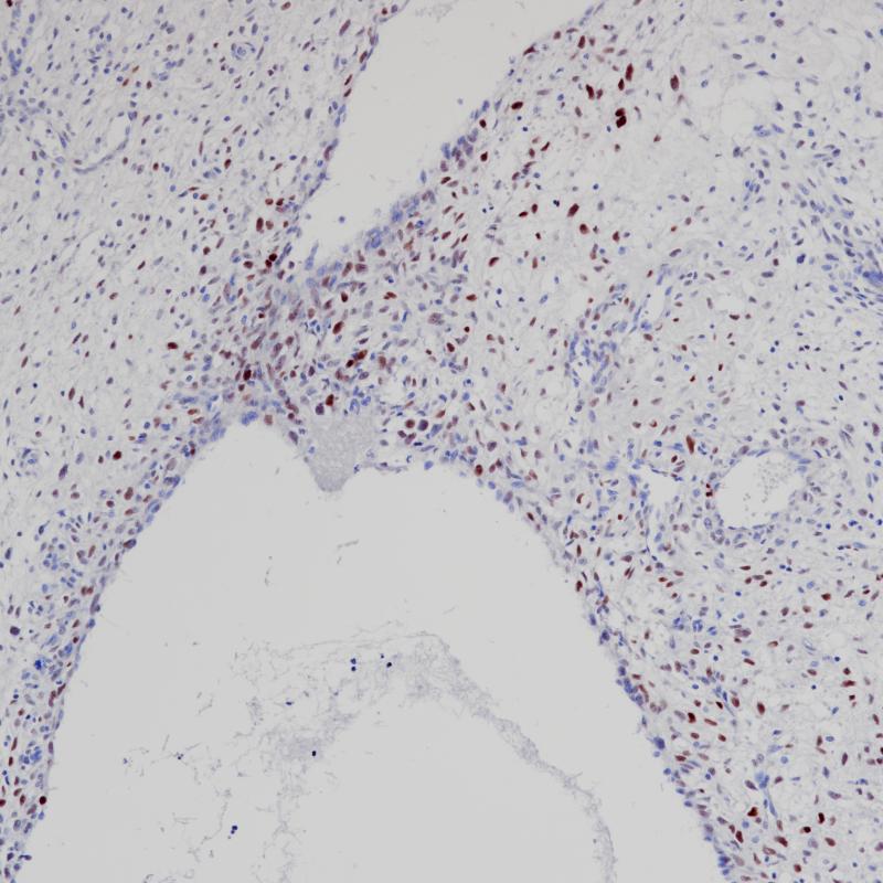 MDM2 Rabbit Monoclonal Antibody(ARB985)