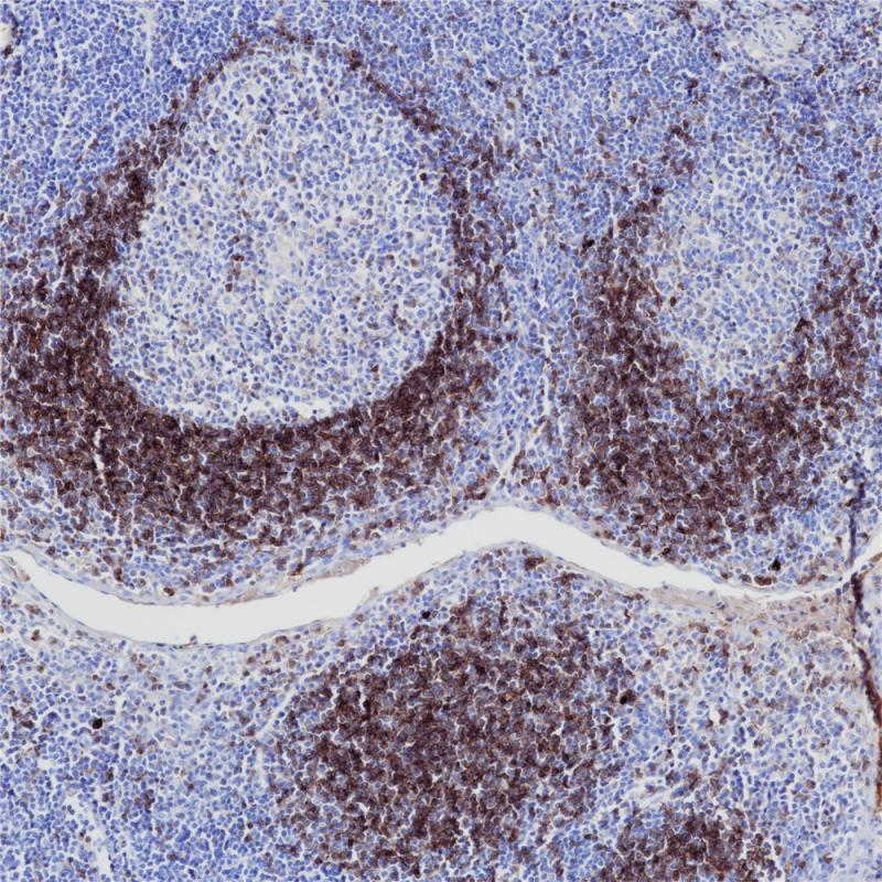 IgD Rabbit Monoclonal Antibody(ARB973)