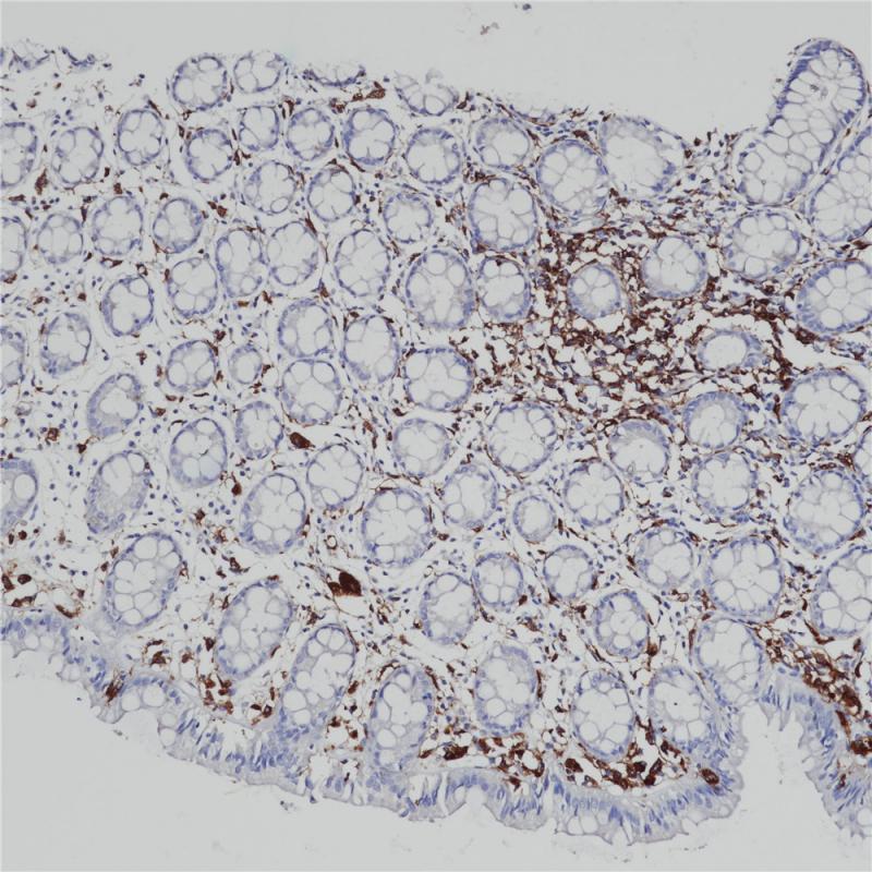 MHC Ⅱ(DR &alpha; chain) Rabbit Monoclonal Antibody(ARB990)