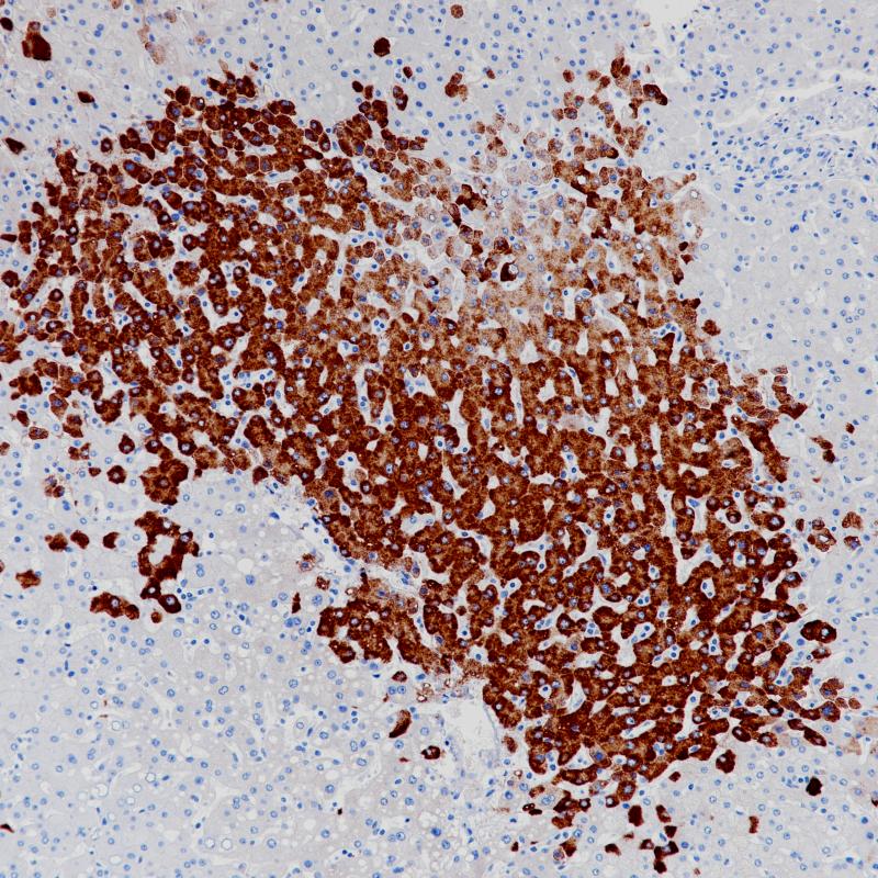 HBSAg Rabbit Monoclonal Antibody(ARB965)