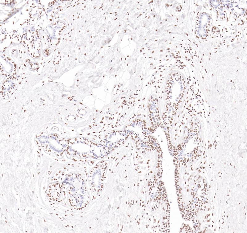 Estrogen receptor beta Rabbit Monoclonal Antibody(ARB950)