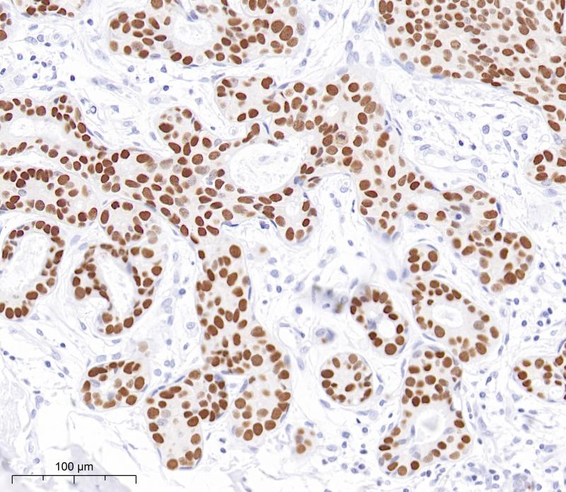 GATA-3 Rabbit Monoclonal Antibody(ARB957)