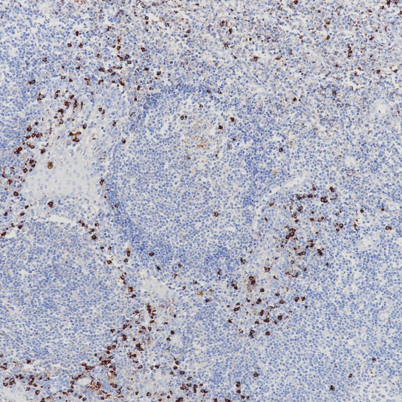 Lambda Light Chains Rabbit Monoclonal Antibody(ARB981)