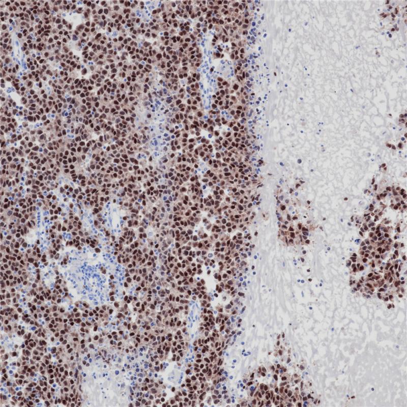 Oct-3/4 Rabbit Monoclonal Antibody(ARB511)