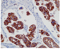 IMP-3 Rabbit Monoclonal Antibody(ARB976)
