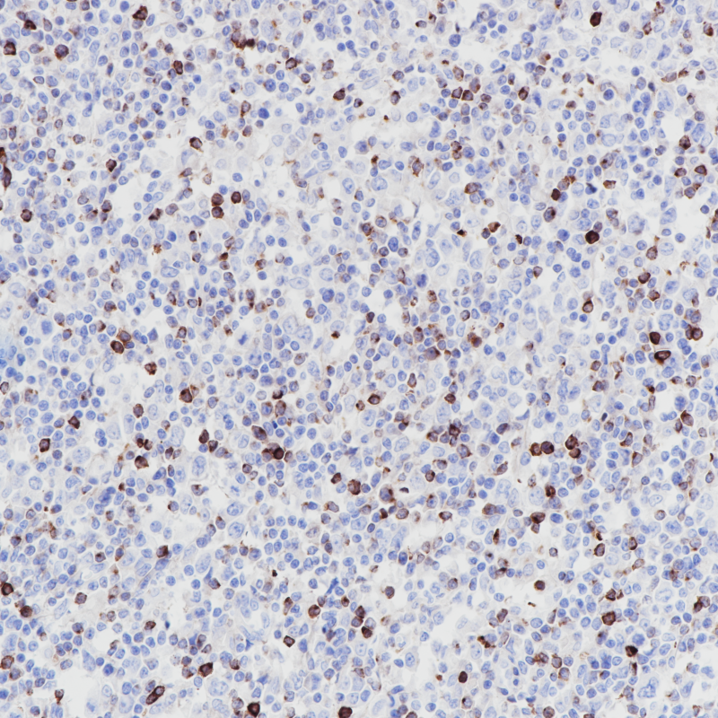 LAG-3 Rabbit Monoclonal Antibody(ARB980)