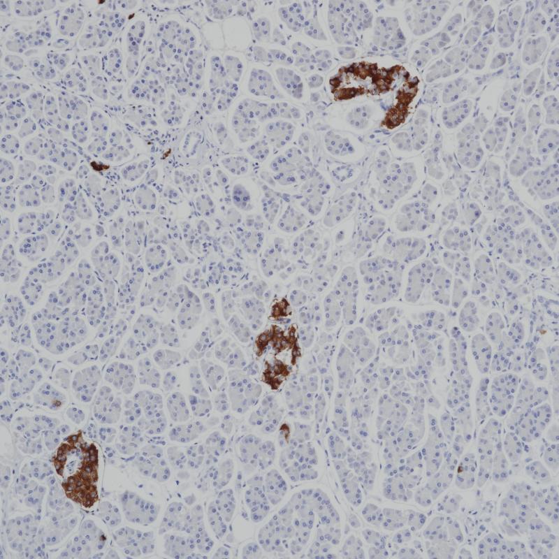Insulin Mouse Monoclonal Antibody(ARB977)