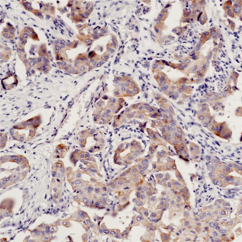 EGFR（L858R) Rabbit Monoclonal Antibody(ARB947)