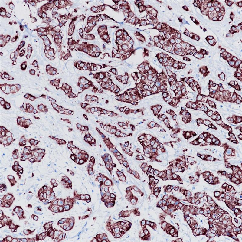 Cytokeratin 7 Rabbit Monoclonal Antibody(ARB941)