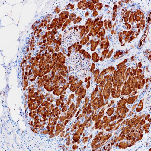 CLPS Rabbit Monoclonal Antibody(ARB923)