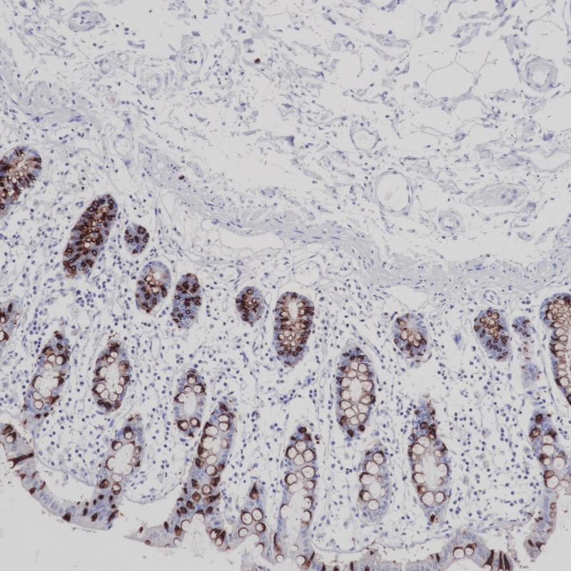 MUC2 Mouse Monoclonal Antibody(ARB994)