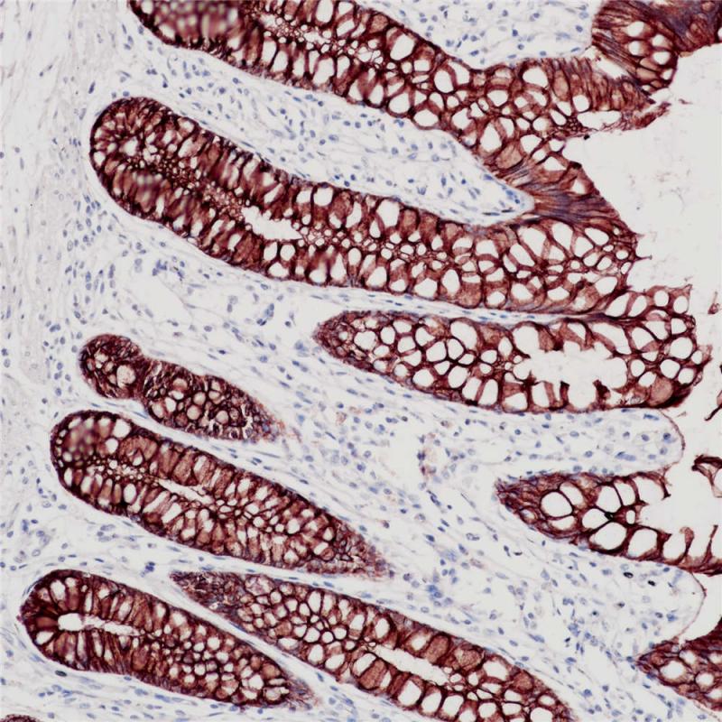 p120 Rabbit Monoclonal Antibody(ARB514)