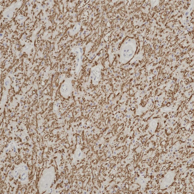 Myelin Basic Protein Rabbit Monoclonal Antibody(ARB999)