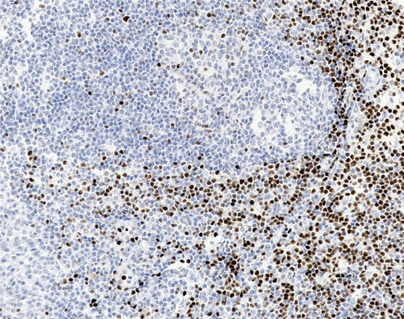 LEF1 Rabbit Monoclonal Antibody(ARB982)