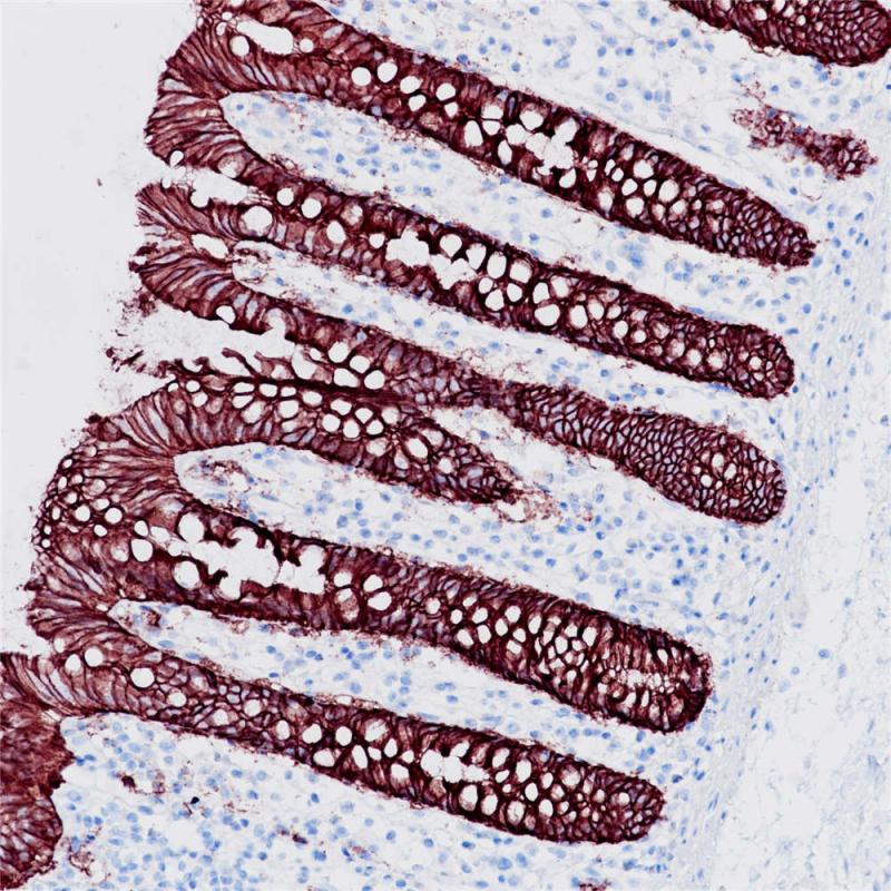 Ep-CAM Rabbit Monoclonal Antibody(ARB948)